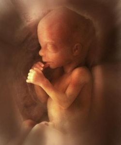 Những biến chứng tiềm ẩn khi mang thai & sinh nở 3